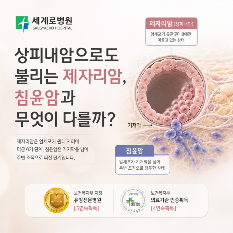<b>상피</b>내암으로도 불리는 제자리암, 침윤암과 무엇이 다를까?