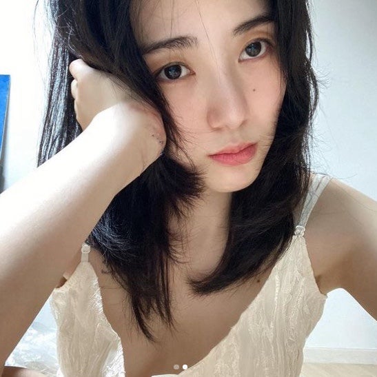 권민아 슈링크 부작용으로 흉터 고백, 법적 공방 예고