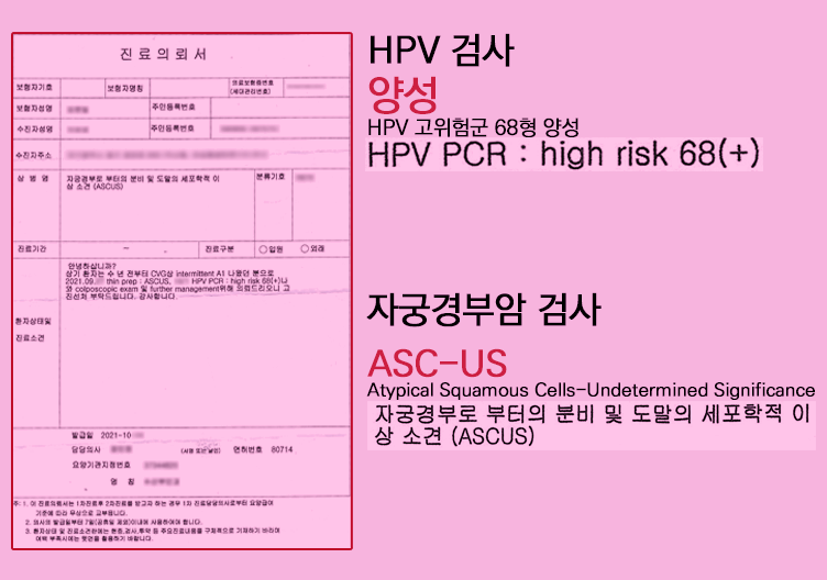 HPV 고위험군 감염 후 자궁경부이형성증까지 얼마나 걸릴까?