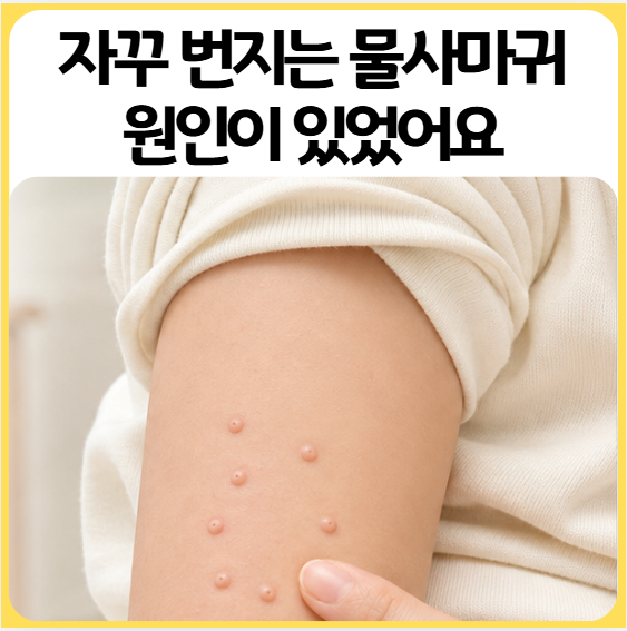 아기 물사마귀 원인 증상 번짐 치료까지 총정리 (연고로 될까?)