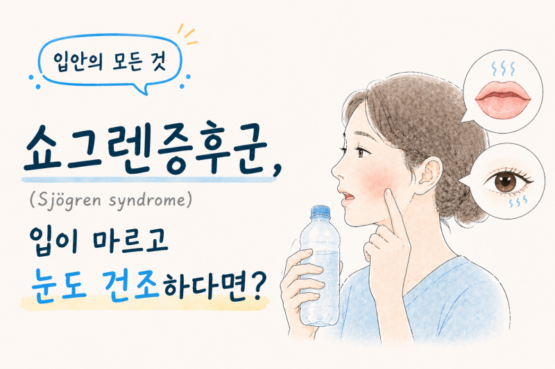 [입 안의 모든 것] 쇼그렌증후군, 입이 마르고 눈도 건조하다면?