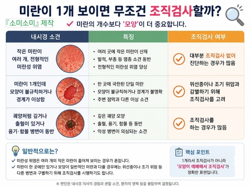 위내시경 결과 미란이란?, 몰라서 직접 공부(일반인 눈높이로 정리) 표재성, 위축성 위염 쉽....