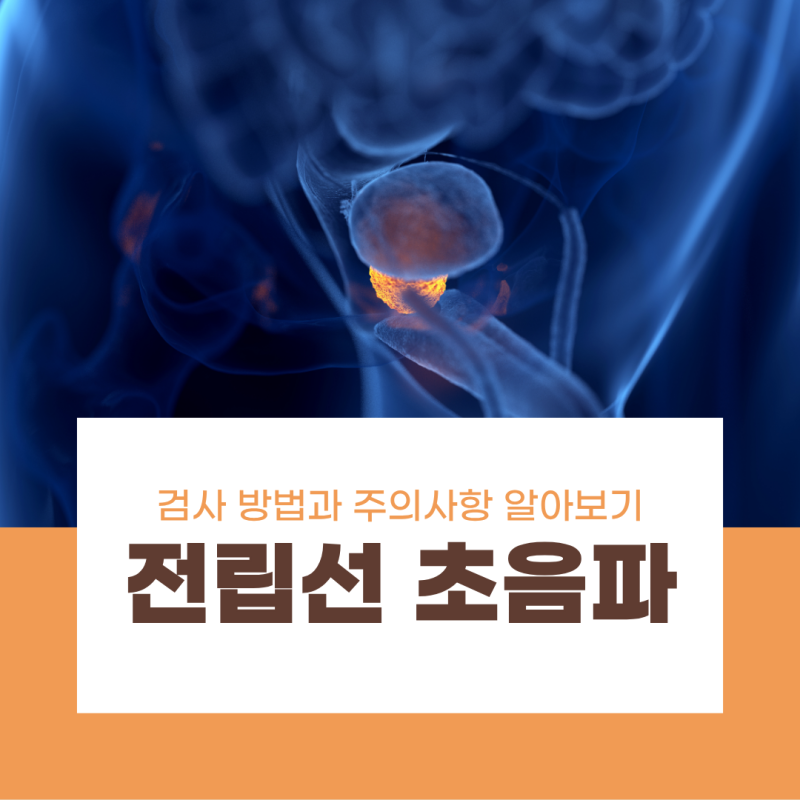 전립선 초음파 검사 방법과 주의사항 알아보기