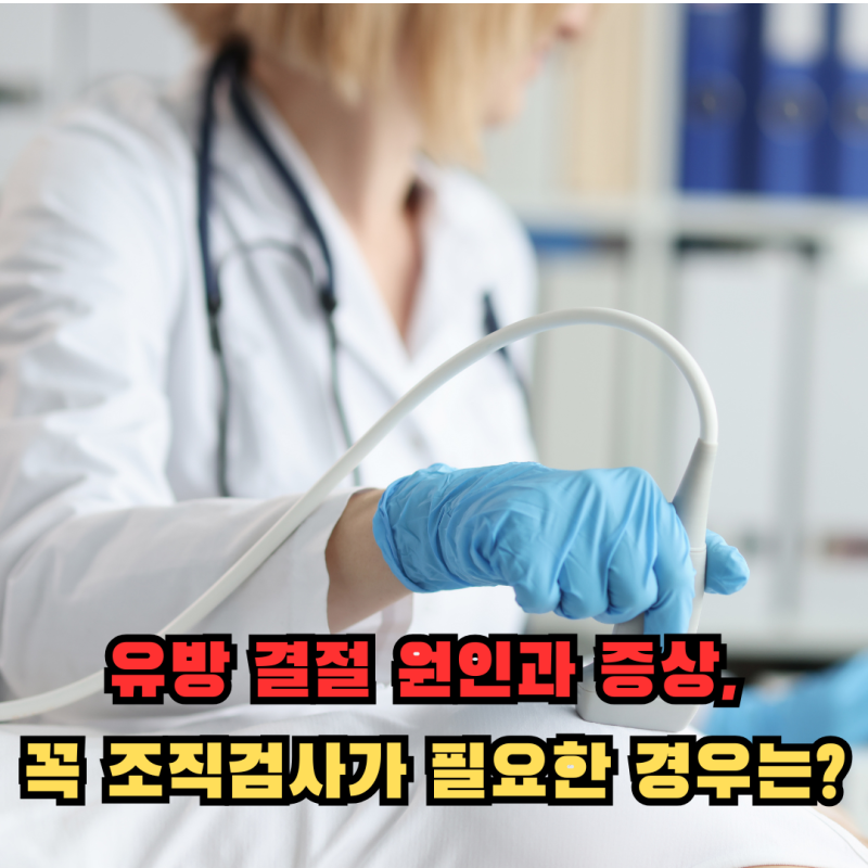 유방 결절 원인과 증상, 꼭 조직검사가 필요한 경우는?