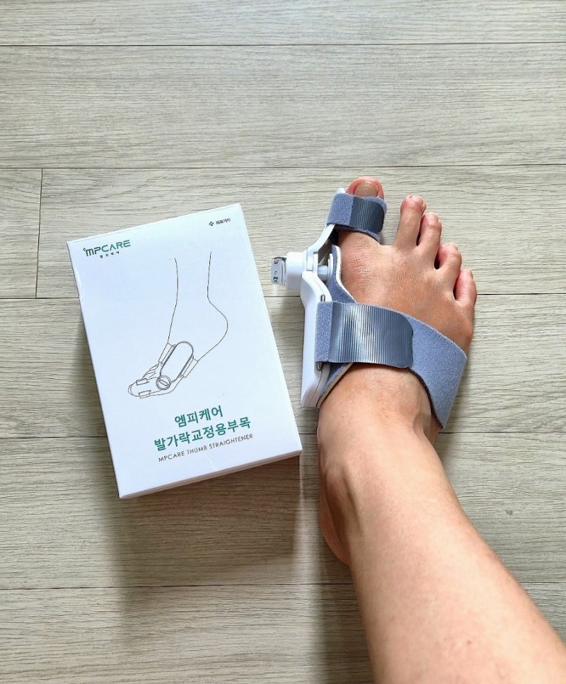 엠피케어 무지외반증 교정기 6개월 사용 후기 | 의료기기 일반기기 비교 | 발가락 교정용 부....