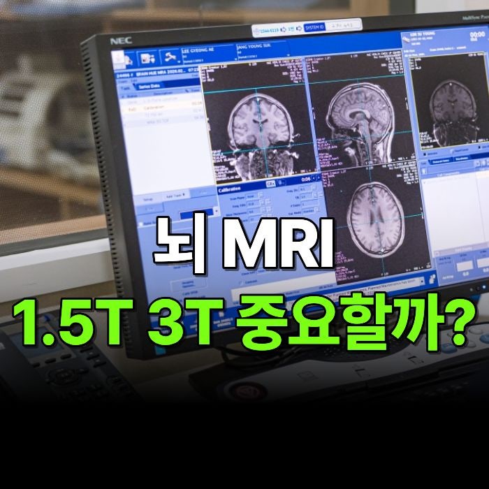 뇌 MRI 검사 1.5T 3T, 결과 차이 있을까?