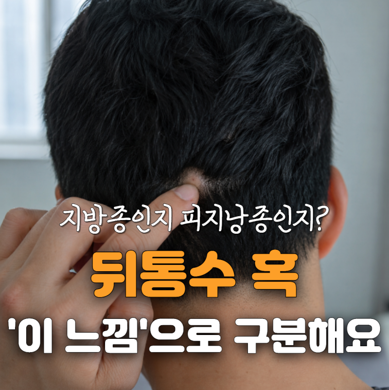 샴푸하다 만져진 뒤통수 혹, 지방종인지 피지낭종인지 헷갈린다면