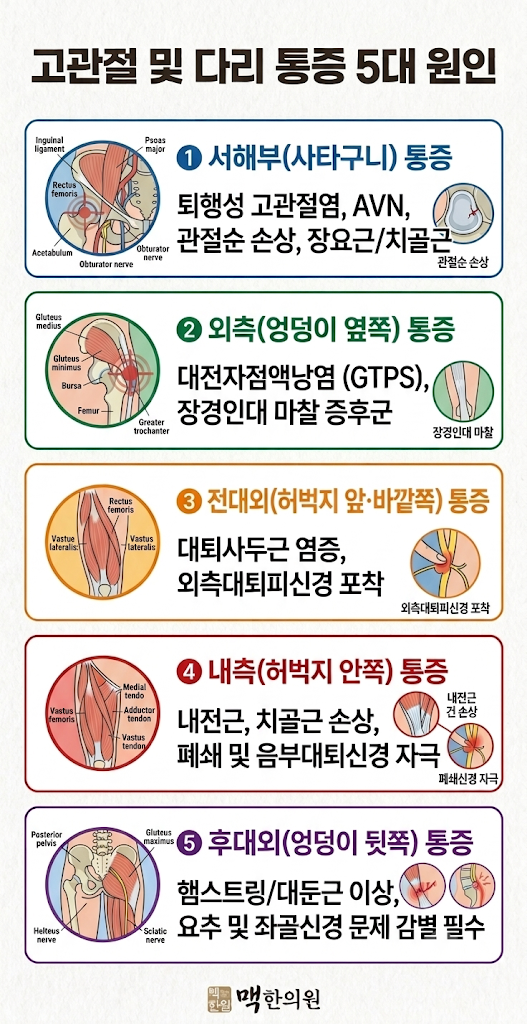 [안산 고관절 한의원] FAQ9. 걸을 때마다 욱신한 고관절 통증 '약침 치료' 어떤가요?