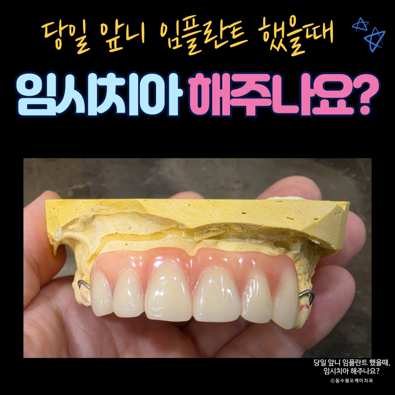 앞니 임플란트 시 당일 임시치아 해주나요?