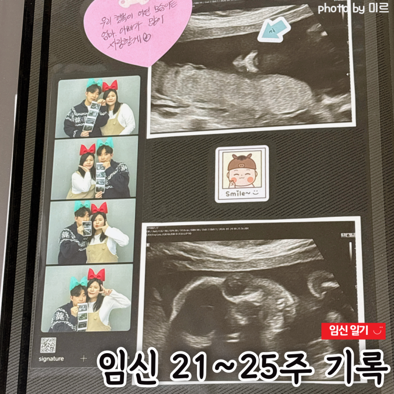 [임신일기] 임신 21주~25주까지의 기록, 입체초음파와 임당 검사하다! (정밀초음파, 자궁근종....