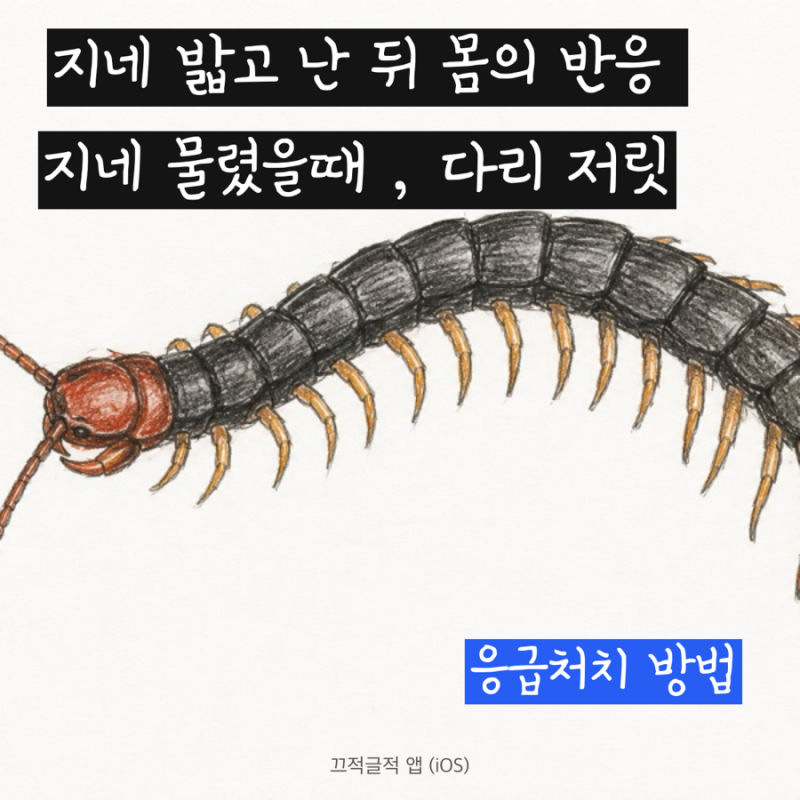 지네 밟고 난 뒤 몸의 반응 I 지네 물렸을때 I 다리 저릿 I 응급처치 방법 I