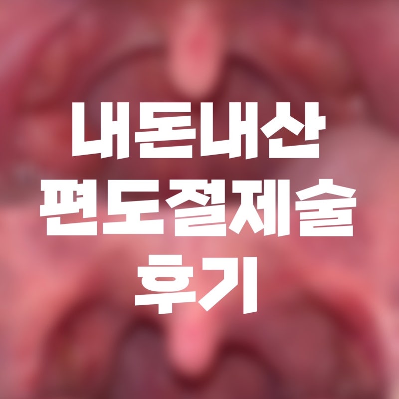 4. 편도절제술 후 3년 후기-지금도 만족할까?장단점/편도염·편도결석재발여부 등 총정리