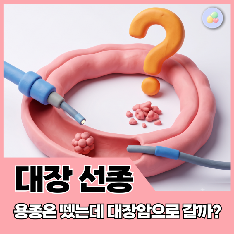 대장내시경 용종 제거 후 선종이라는데, 암으로 가는 걸까요? 약사가 보는 결과지 기준