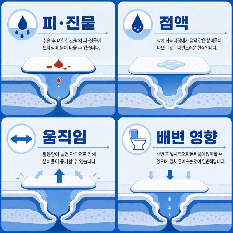 치질수술 후 거즈는 언제 교체해야 하나요?