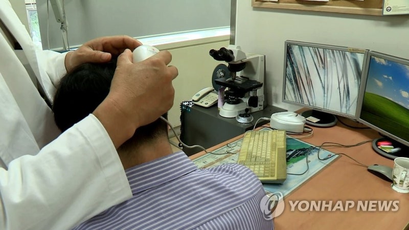 탈모 치료제 건강보험 확대, 왜 논란일까? 재정 부담과 형평성 쟁점