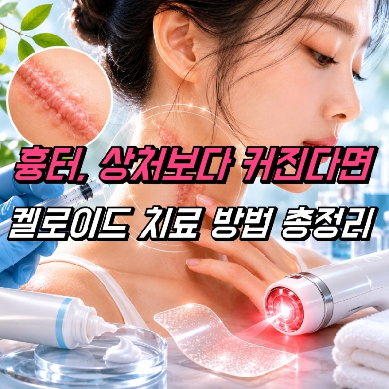 켈로이드 흉터 치료 방법, 주사 연고 레이저