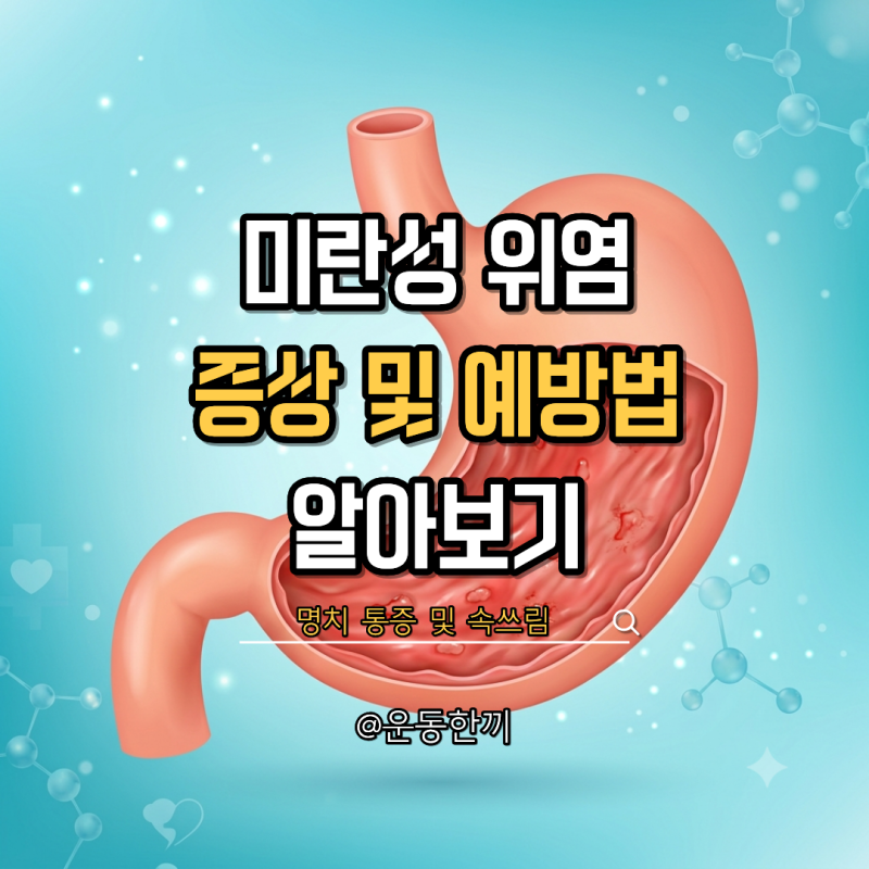 미란성 위염 증상 검사방법 예방법