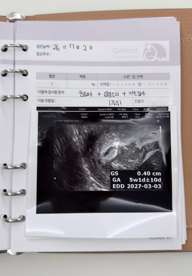 [천안 퀸스<b>산부인과</b>] 임신 5주 첫 검진 후기｜아기집 확인, 피고임 ....
