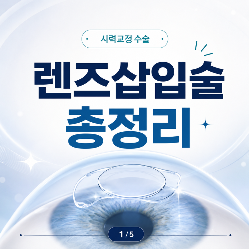 렌즈삽입술 총정리
