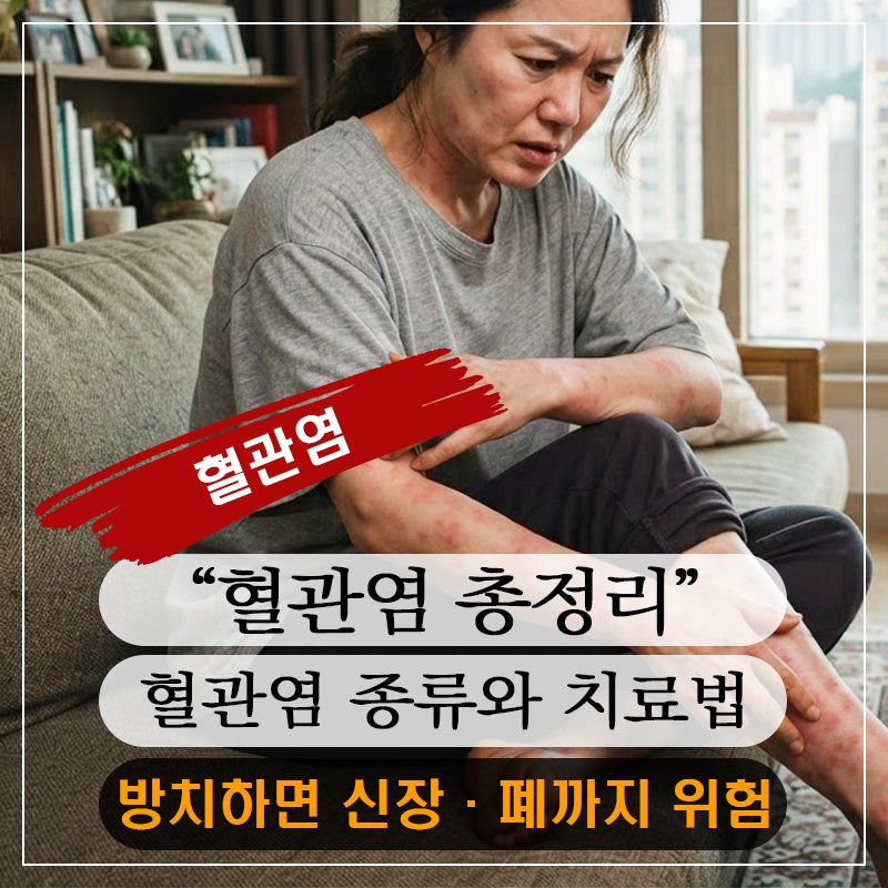 원인 모를 발진과 통증, 혈관염이 보내는 위험 신호일 수 있습니다