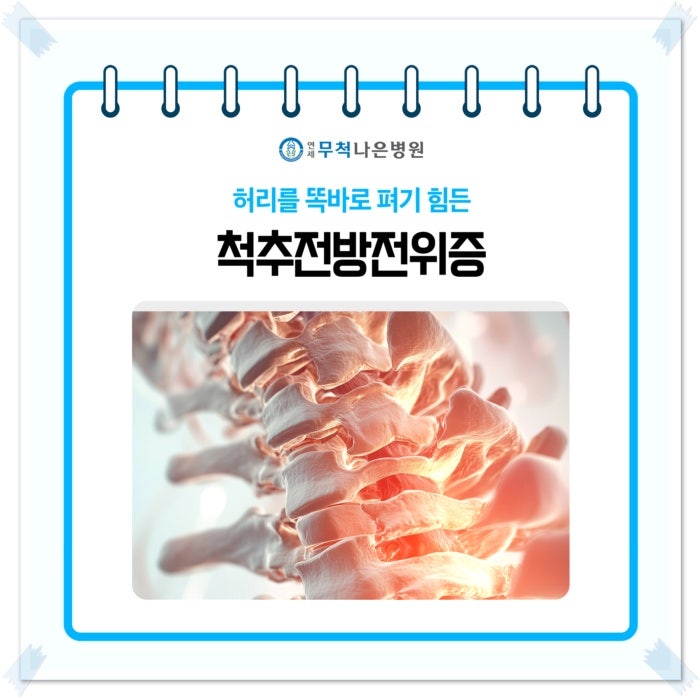 동대문구 척추전방전위증 운동법 해도 되는 운동은 무엇일까요?
