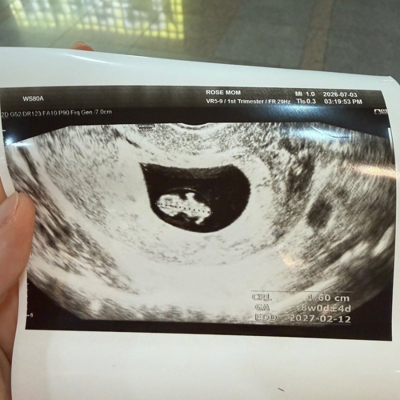 임신8주차 창원로즈맘산부인과 진료,초음파