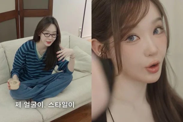 "성형한 줄 알았다"... 강민경 얼굴 확 달라진 진짜 이유 공개