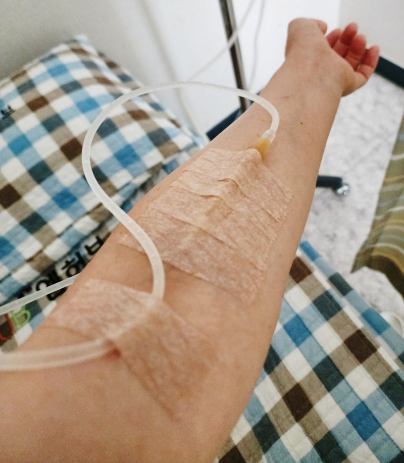 극난저 시험관, 대전에서 아르기닌주사 백옥주사 신데렐라주사 비용 및 맞은 후기