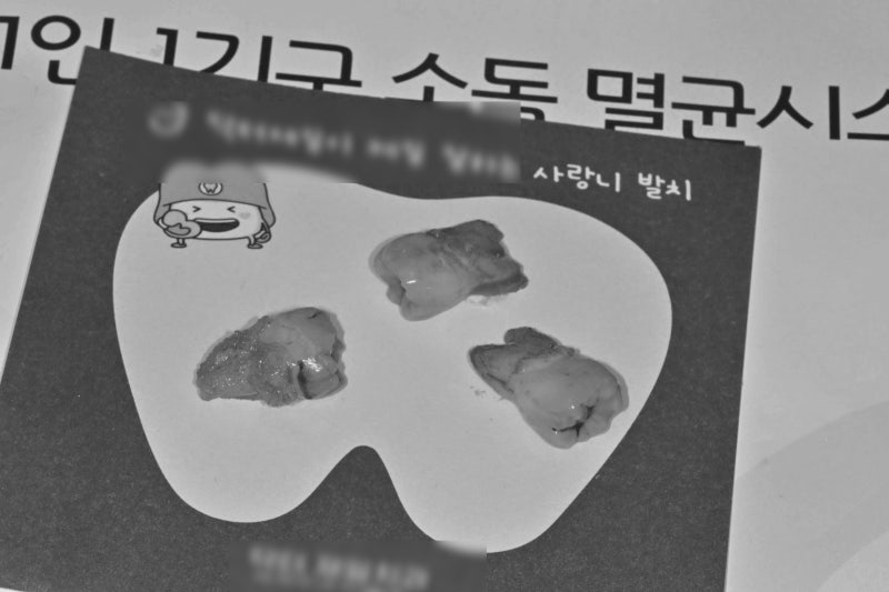 사랑니발치 후 통증 목통증 증상부터 실밥제거 발치후 식사 운동 시기 총정리 (의식하진정 ....