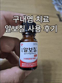 구내염 알보칠 후기｜가격·사용법·통증·효과까지 직접 사용해본 솔직 후기
