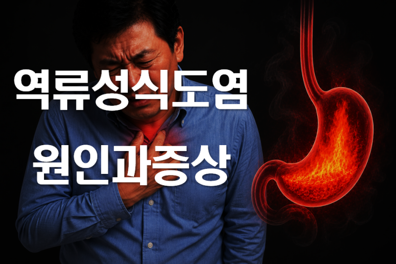 역류성식도염 원인과 증상