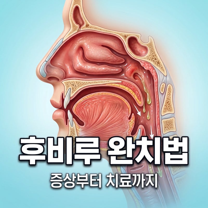후비루증후군 증상 치료 방법! 목 이물감 해결하는 완벽 가이드