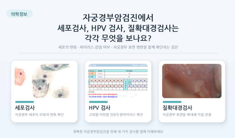 자궁경부암검진에서 세포검사, HPV검사, 질확대경검사는 각각 무엇을 보나요?