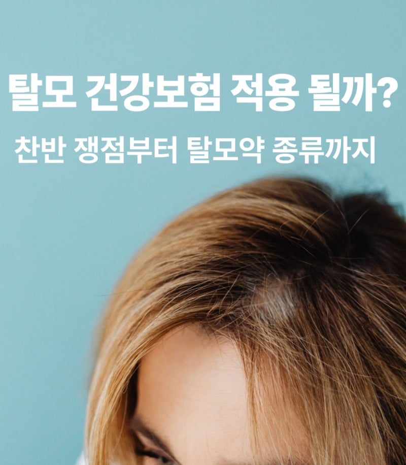 탈모 건강보험 적용 될까? 찬반 쟁점부터 탈모약 종류까지 한번에 정리