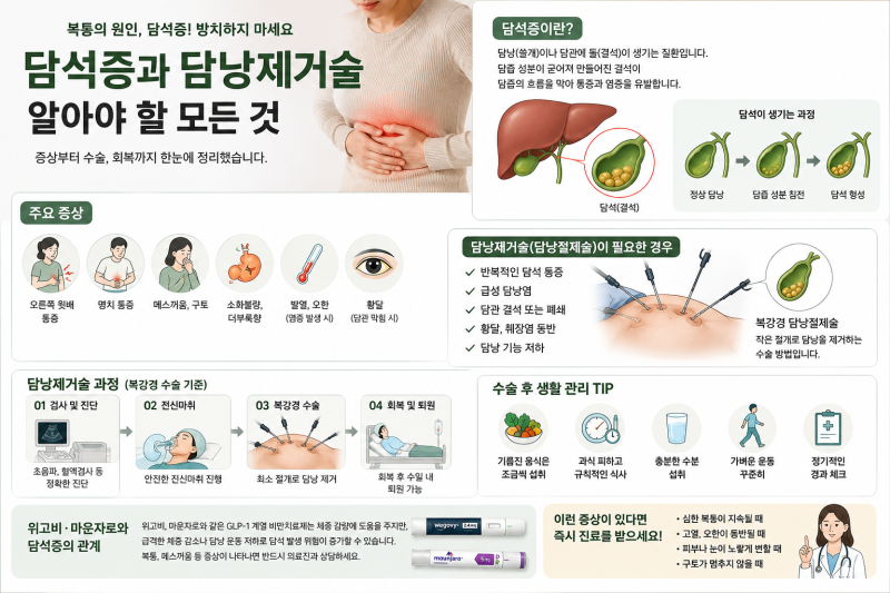 담석증으로 담낭절제술 받은 후기｜담소유병원 선택 이유와 회복 과정까지