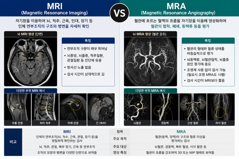 MRI vs MRA | CT vs X-ray 가격 비교