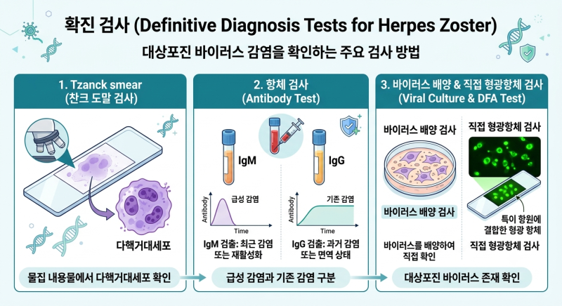 대상포진 | 진단, 증상, 신경통, 치료, 재발, 예방접종