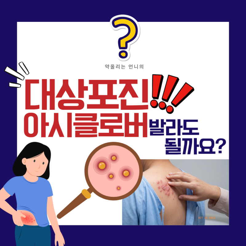 대상포진에 바르는 약(아시클로버 연고), 발라도 될까요?약사가 솔직하게 정리했어요!