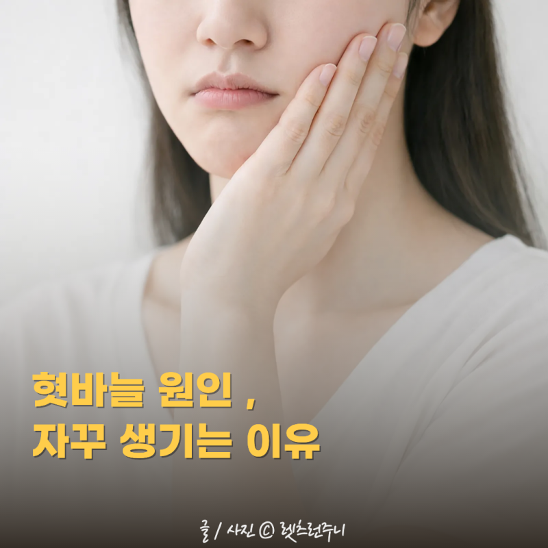 혓바늘 원인 , 자꾸 생기는 이유 따로 있어요