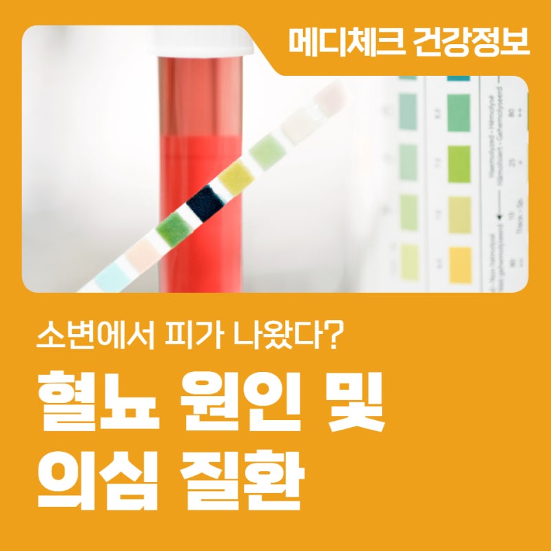 소변에서 피가 나왔다? 혈뇨 원인 및 의심 질환