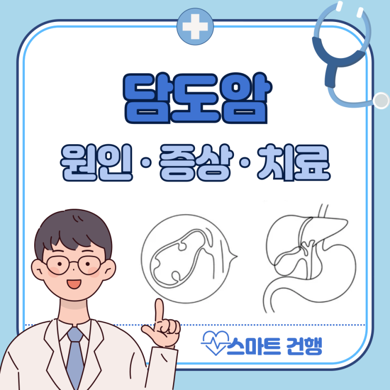 담도암 증상, 원인, 치료법, 수술 : 1~4기 생존율