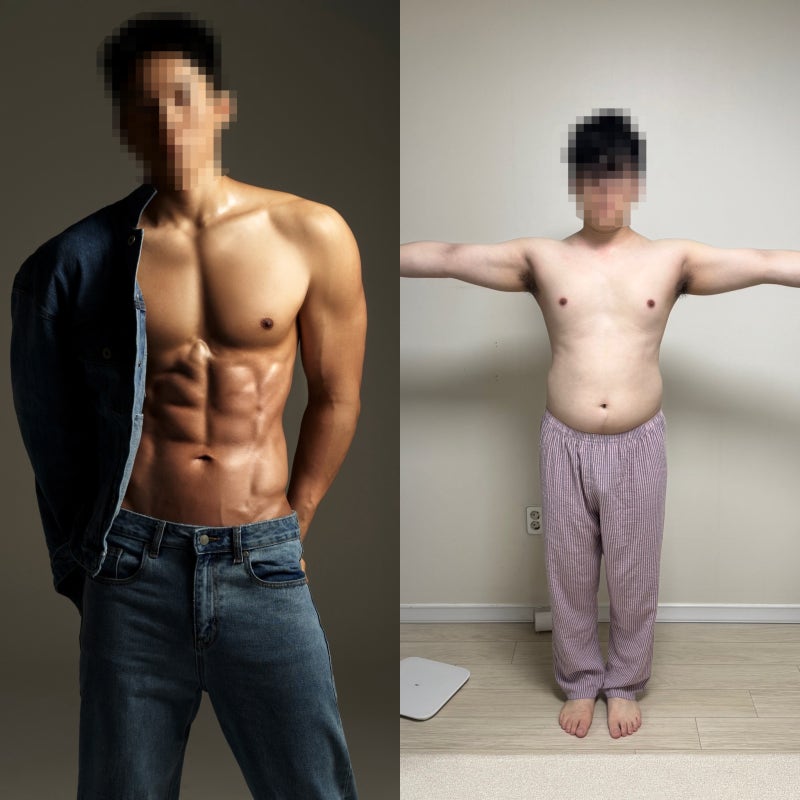 마운자로 처방 가격 비교 닥터나우로 최저가 찾아 내돈내산 시작한 이유