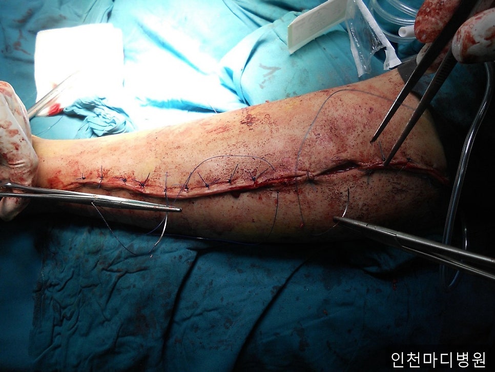 인천마디병원