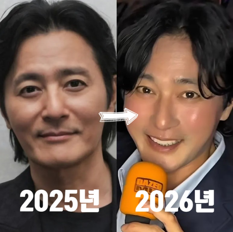 장동건 성형수술 근황 안면거상 시술 고소영 리즈시절 장동건 나이