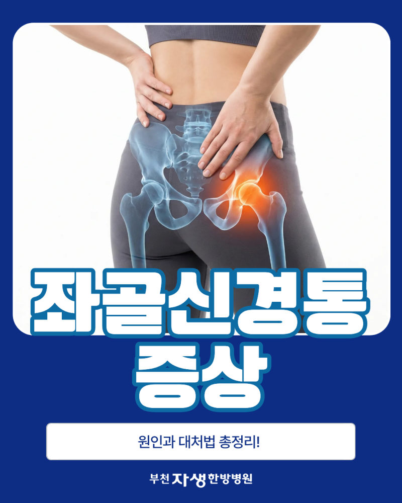 엉덩이부터 다리까지 찌릿한 통증, ‘좌골신경통증상’ 원인과 대처법 총정리!