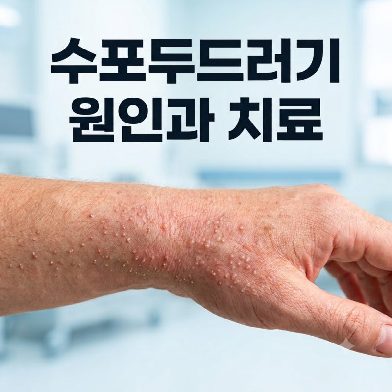 수포두드러기 왜 생길까? 원인과 치료방법 쉽게 알아보기