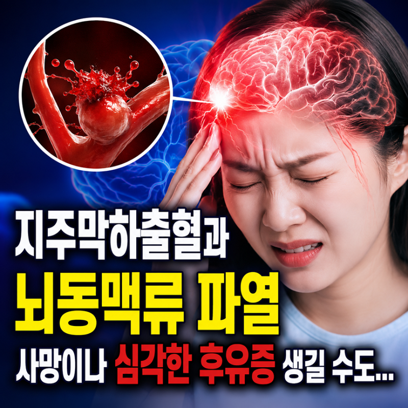 지주막하출혈과 뇌동맥류 파열, 사망이나 심각한 후유증 생길 수도...