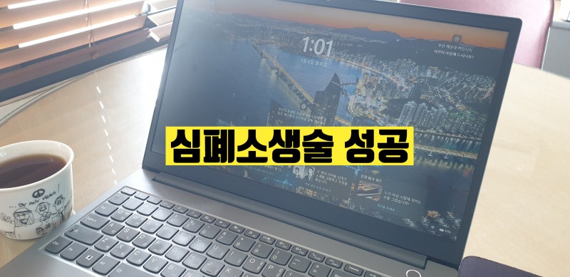 노트북 화면 갑자기 안켜져서 깜깜할 때, 1분 만에 해결하는 응급조치 방법 4가지