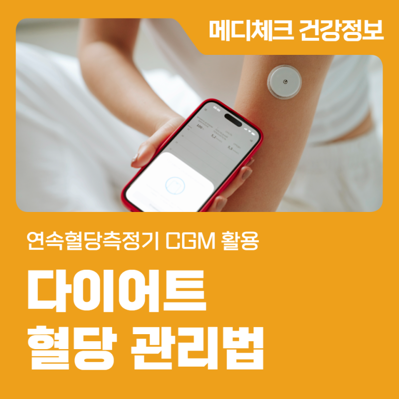 연속혈당측정기 CGM 활용 다이어트 혈당 관리법