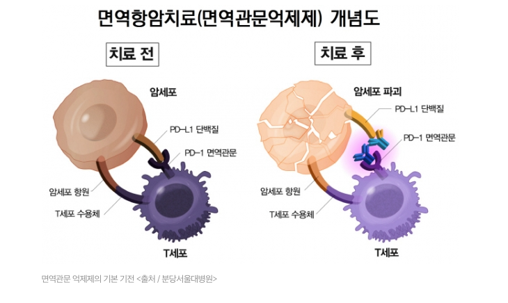 지금 암 치료, 여기까지 왔어요 - 2026년 현재 가장 주목받는 치료제 5가지 총정리 (가격·효과....